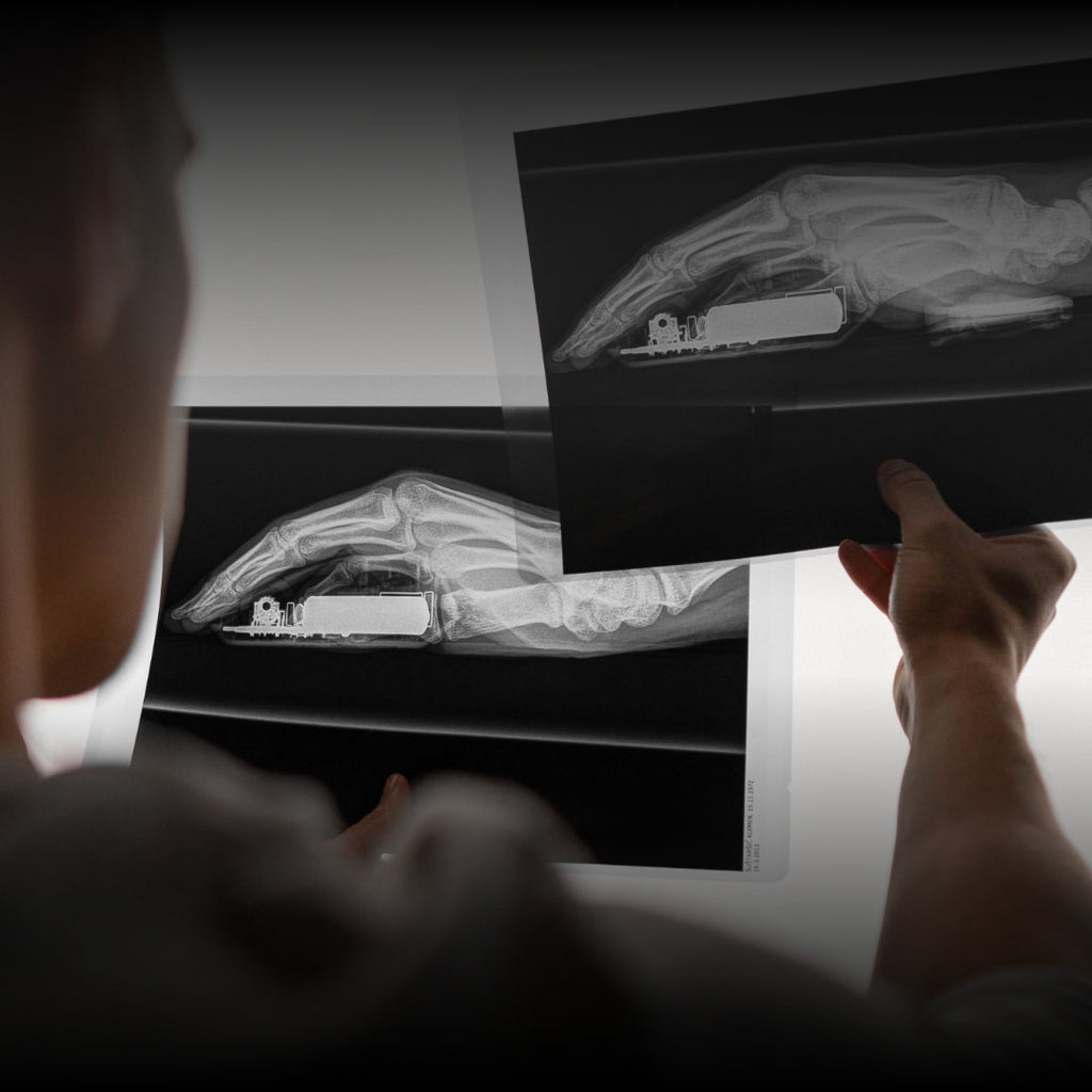 Deltahub - Carpio G2.0 - Ergonomic Wrist Rest